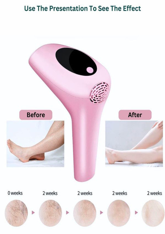 SOLARAE IPL Hair Removal Device for Women & Men 900000 Flash Laser Hair Removal Systems Whole Body Hair Removal Machines for Face Bikini Underarms Legs (Pink) - Treasure Box Fze LLC